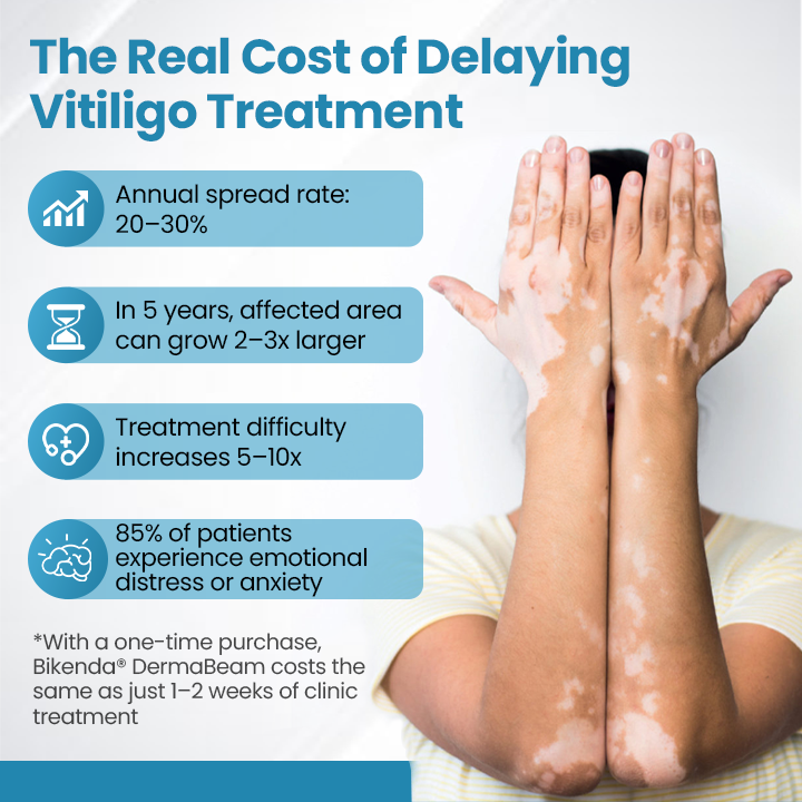 Bikenda® DermaBeam Vitiligo Therapy Device💎