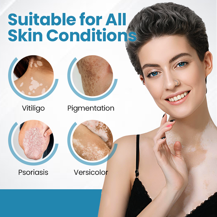 Bikenda® DermaBeam Vitiligo Therapy Device💎