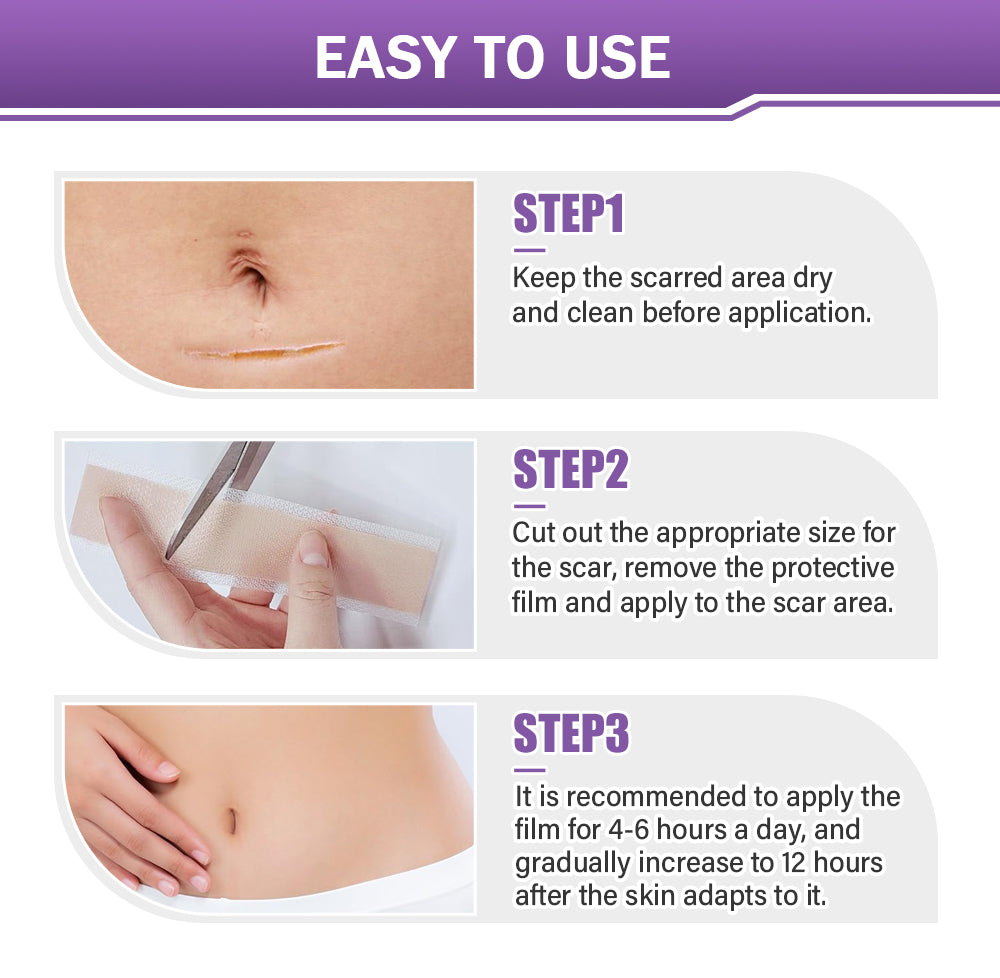 ✅Official Store |𝖤𝖰𝖵𝖯® Hyaluronic Acid Nano Microneedle Repair Tape 🏥(Treatment of old and new scars, reduction of surgical scars, stretch marks, keloids, acne, burns, warts, dermatomes and varicose veins)