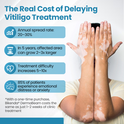 Bikenda® DermaBeam Vitiligo Therapy Device💎