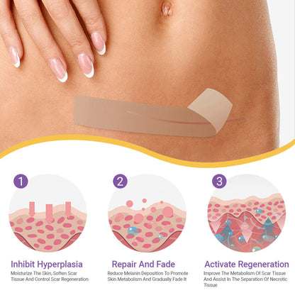 ✅Official Store |𝖤𝖰𝖵𝖯® Hyaluronic Acid Nano Microneedle Repair Tape 🏥(Treatment of old and new scars, reduction of surgical scars, stretch marks, keloids, acne, burns, warts, dermatomes and varicose veins)